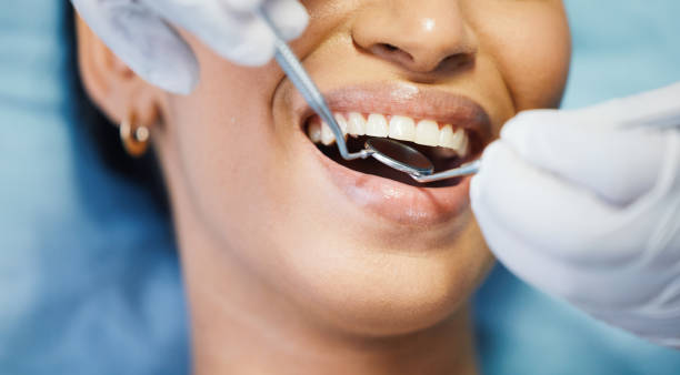 Best Emergency Treatment for Dental Infections or Abscesses in Ruston, LA