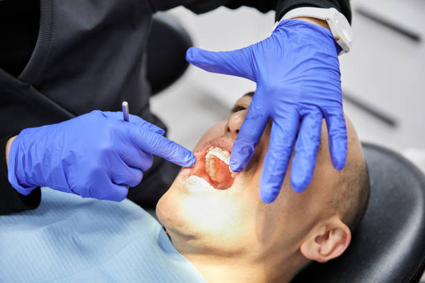 Best Emergency Tooth Extraction in Ruston, LA